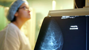 mammogram